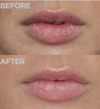 Load image into Gallery viewer, Before and after using Nayjor Beauty Lip Scrub – Dry, chapped lips transformed into smooth, moisturized lips.
