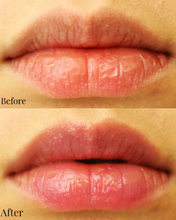 Load image into Gallery viewer, Before and after using Nayjor Beauty Lip Scrub – Dry, chapped lips transformed into smooth, moisturized lips